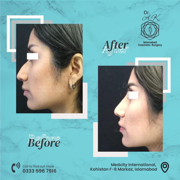 Advanced cosmetic surgery facility Islamabad