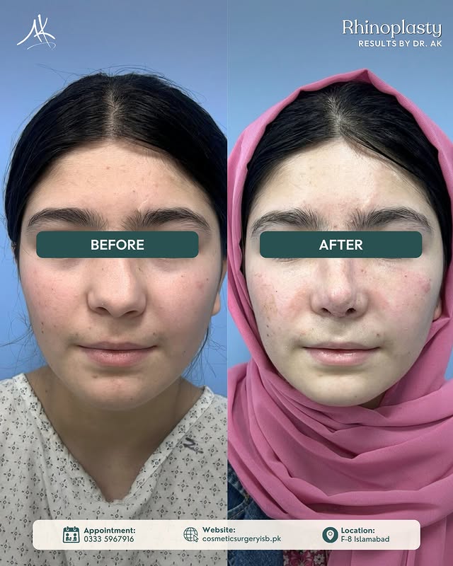 Clinic front image Rhinoplasty Islamabad